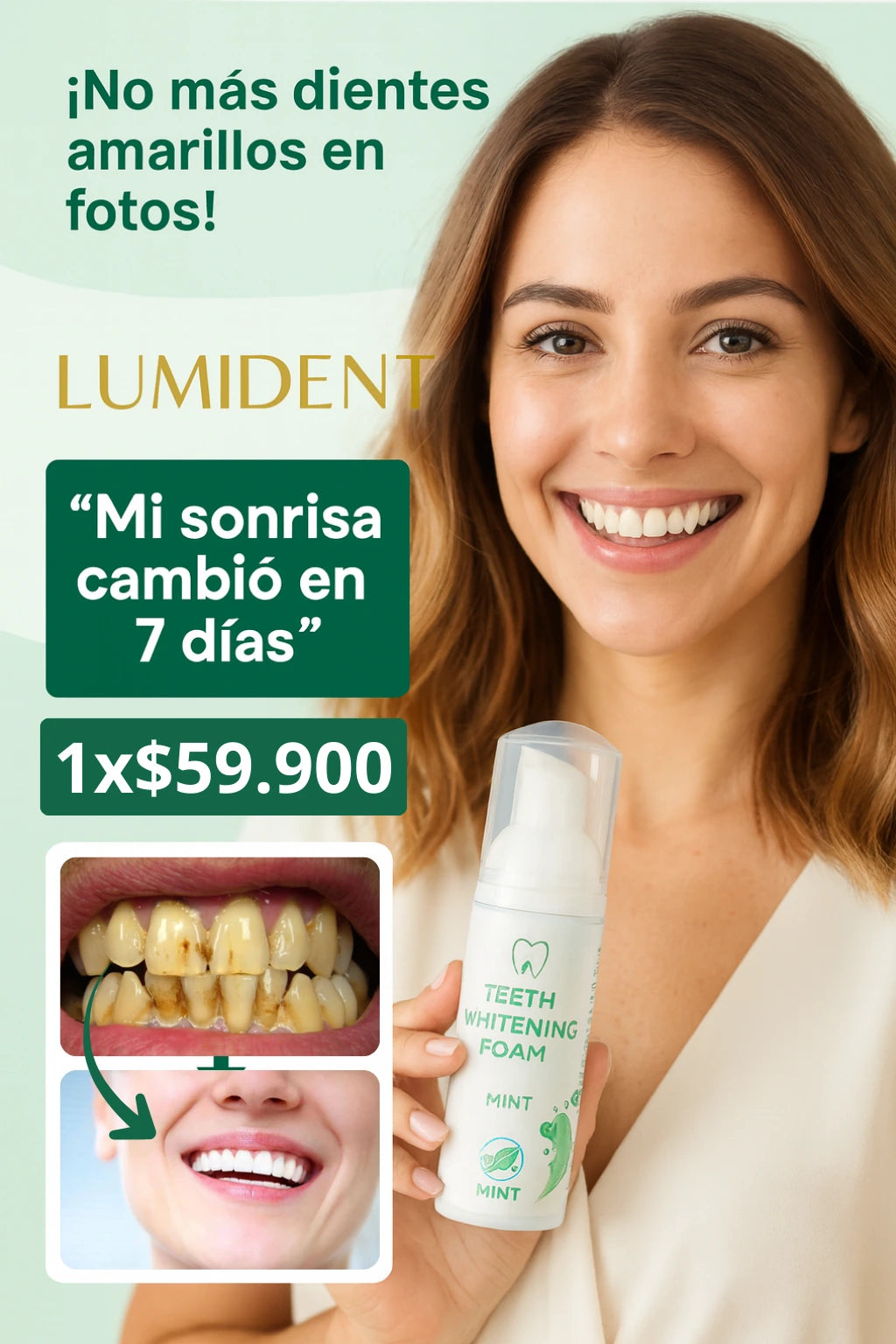 Lumident | Sonrisa blanca en segundos...